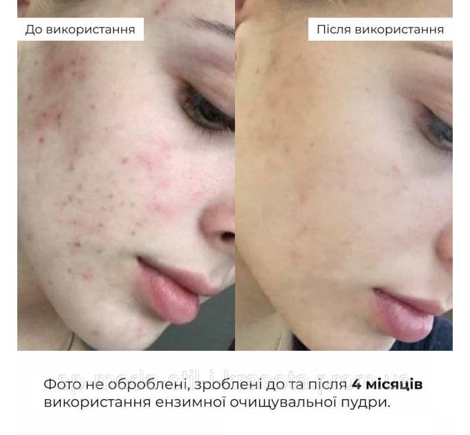 Набір ніжного очищення та глибокого живлення для сухої та чутливої шкіри Hillary for dry and sensitive skin