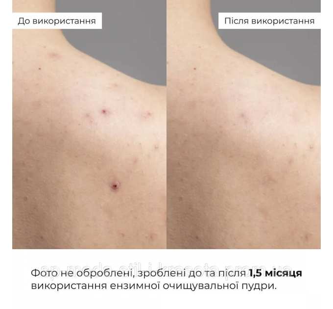 Набір ніжного очищення та глибокого живлення для сухої та чутливої шкіри Hillary for dry and sensitive skin