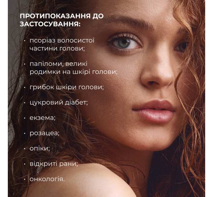 Мезороллер для шкіри голови Hillary