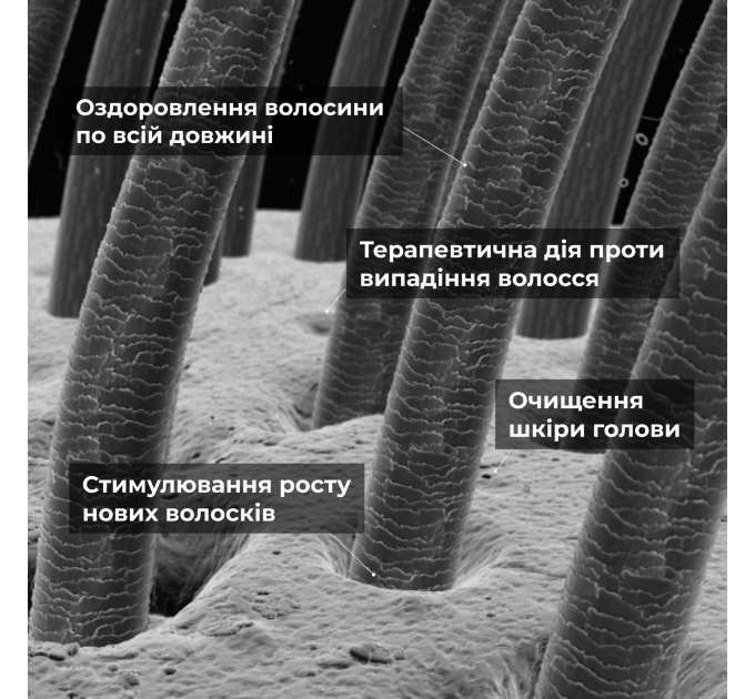 Мезороллер для шкіри голови Hillary + Комплекс проти випадіння волосся