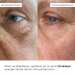 Розгладжувальні патчі з біо-ретинолом Hillary Bacuchiol Wrinkle Correcting & Eye Lift Patches, 60 шт