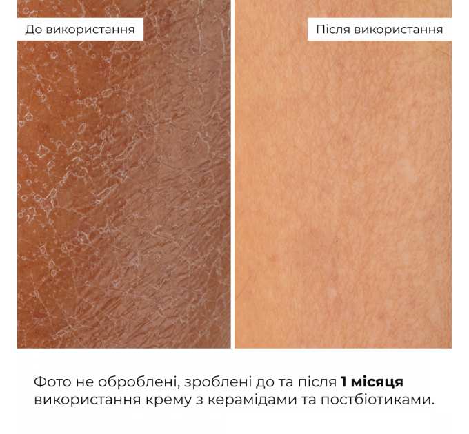 Відновлювальний крем з керамідами та постбіотиками Hillary Barrier Restoring Ceramide Cream, 50 мл