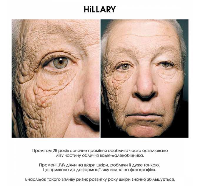 Набір для літнього догляду Hillary Perfect Summer 8
