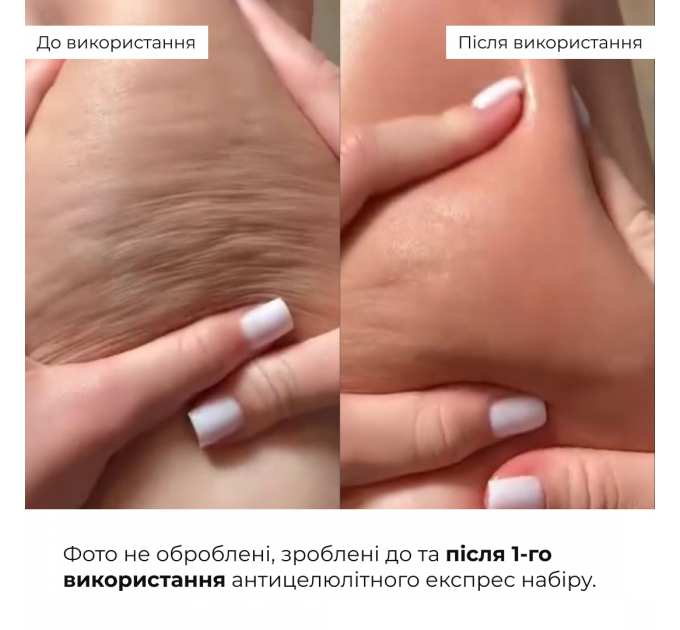 Антицелюлітний експрес набір Hillary Anti-Cellulite EXPRESS Sculpt Set