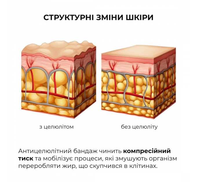 Антицелюлітний експрес набір Hillary Anti-Cellulite EXPRESS Sculpt Set
