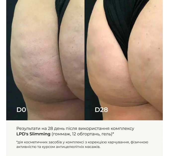 Набір вакуумних банок для тіла + Антицелюлітні засоби LPD's Slimming