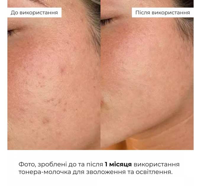 Тонер-молочко для зволоження та освітлення шкіри Hillary Milky Glow Toner, 100 мл
