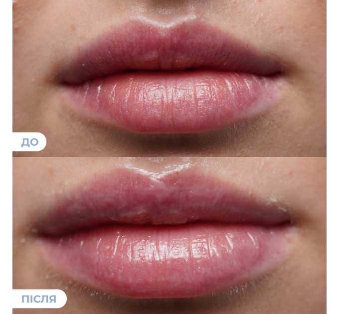 Набір від лущення та для зволоження губ Hillary Exfoliate & Hydrate Lip Duo