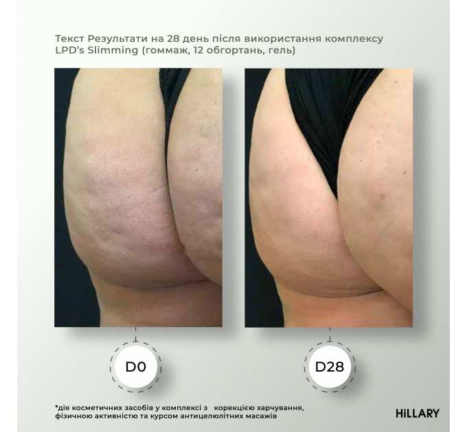 Рідина для антицелюлітних ліпосомальних обгортань Hillary Anti-cellulite Bandage LPD'S Slimming Fluid