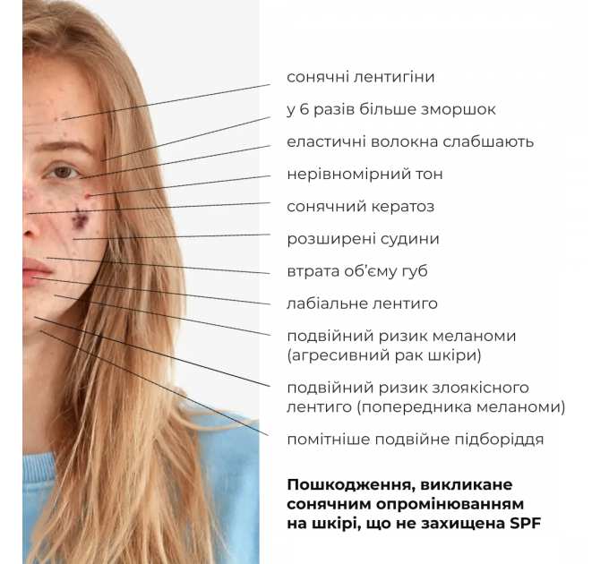 Набір для освітлення та захисту шкіри з вітаміном С і азелаїновою кислотою Hillary Azelaic & Vitamin C Brightening & SPF Protection Set