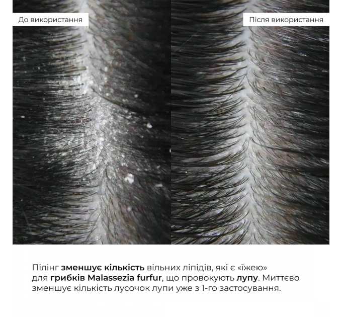 Ензимний трихологічний пілінг для шкіри голови Hillary Enzyme Trichological Scalp Peel, 120 мл