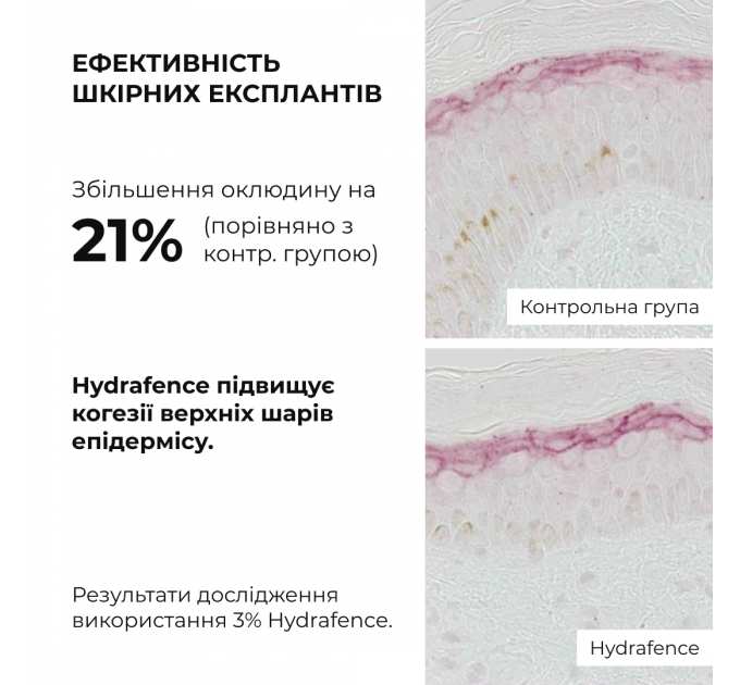 Весняний догляд для нормального типу шкіри