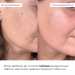Ліфтинг-маска для обличчя та шиї Hillary Collagen & Peptide Lifting Clay Mask, 90 мл