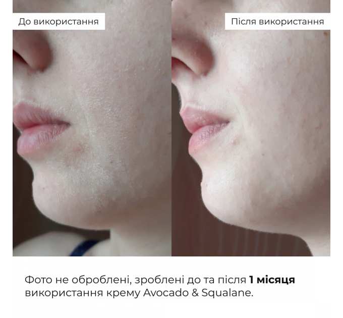 Весняний догляд для сухого типу шкіри