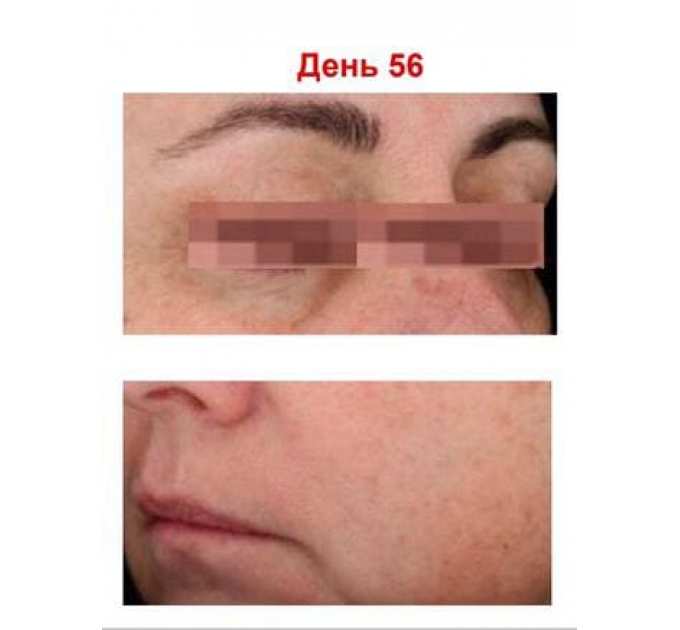Антиоксидантна пептидна сироватка з вітаміном С Hillary Antioxidant Age Reverse Serum 30+, 30 мл