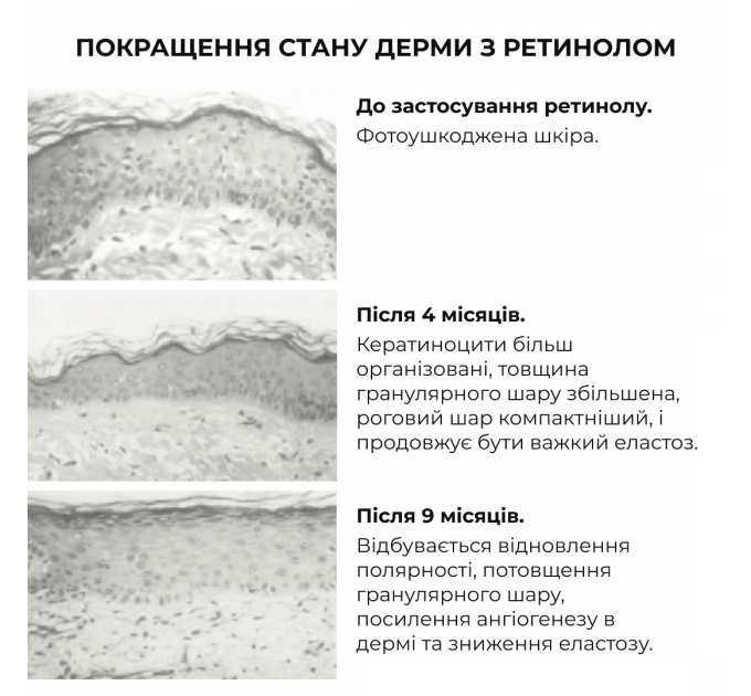 Сироватка для активного відновлення шкіри Hillary ReNuAge Retinol Active Renewal Serum, 30 мл