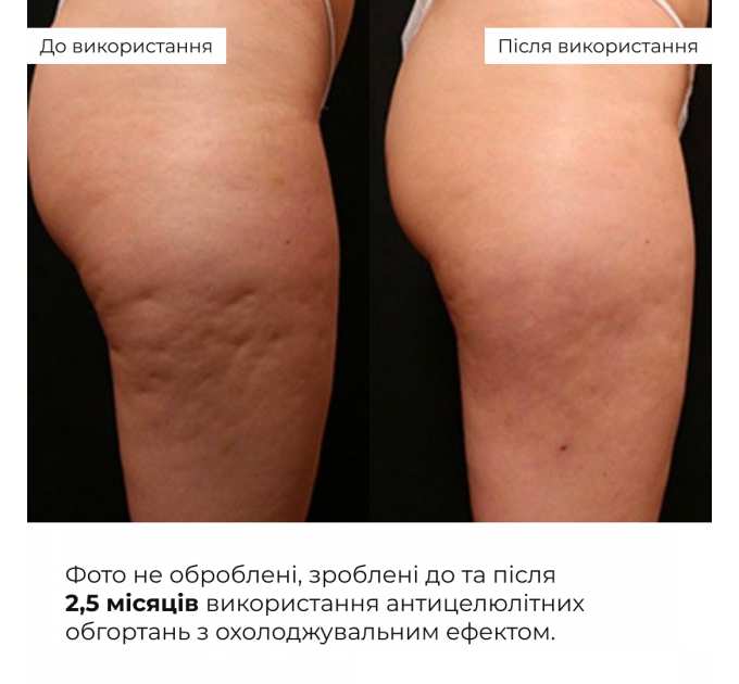 Курс охолоджуючих антицелюлітних обгортань для тіла Hillary Anti-Cellulite Pro cooling effect (6 уп.)