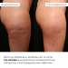 Курс охолоджуючих антицелюлітних обгортань для тіла Hillary Anti-Cellulite Pro cooling effect (6 уп.)