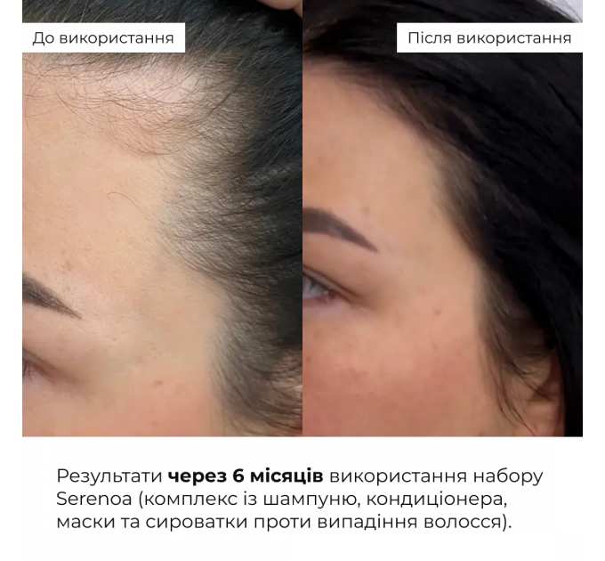 Сироватка для волосся Concentrate Serenoa + Шампунь для всіх типів волосся Nori Micellar та гребінь