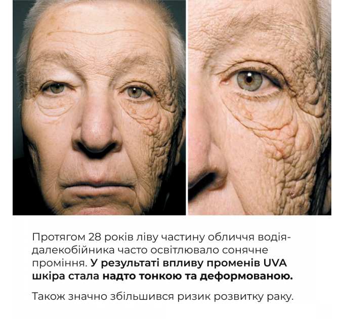 Комплекс для відновлення тону та захист від пігментації Hillary Tone Repair & Pigment Defense Set