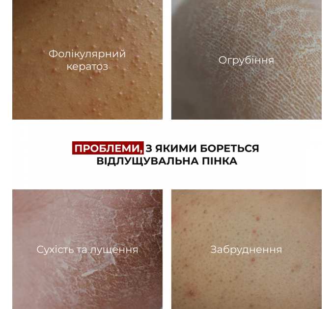 Мʼяка відлущувальна пінка з кислотами для тіла Hillary Soft Exfoliation AHA Body Foam, 150 мл