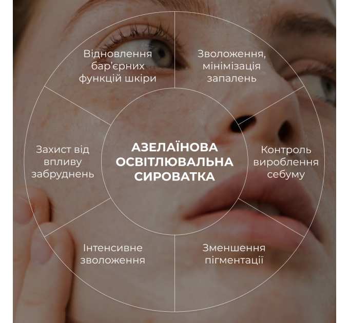 Азелаїнова освітлювальна сироватка Hillary Azelight Defense Serum, 30 мл