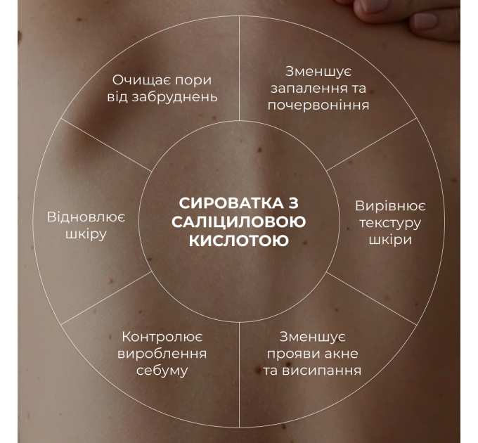 Сироватка для проблемної шкіри з саліциловою кислотою Hillary Back & Body Acne Control Serum, 50 мл