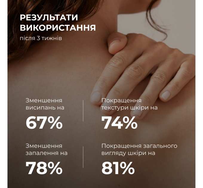 Сироватка для проблемної шкіри з саліциловою кислотою Hillary Back & Body Acne Control Serum, 50 мл
