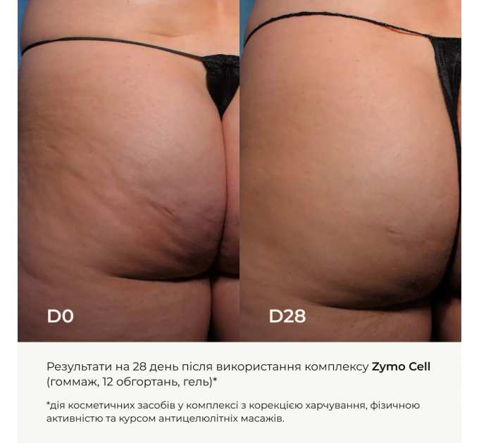 Антицелюлітний ензимний гель Hillary Anti-cellulite Gel Zymo Cell, 200 мл