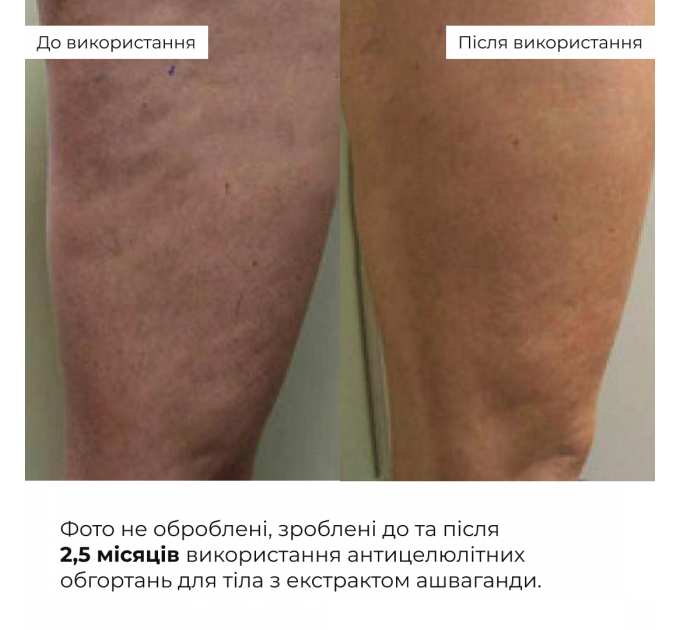 Набір антицелюлітних розігрівальних обгортань Hillary Heating Anti-Cellulite Wrap Set