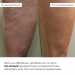 Набір антицелюлітних розігрівальних обгортань Hillary Heating Anti-Cellulite Wrap Set