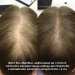 Комплекс проти випадіння волосся Hillary Serenoa &amp; РР Hair Loss Control
