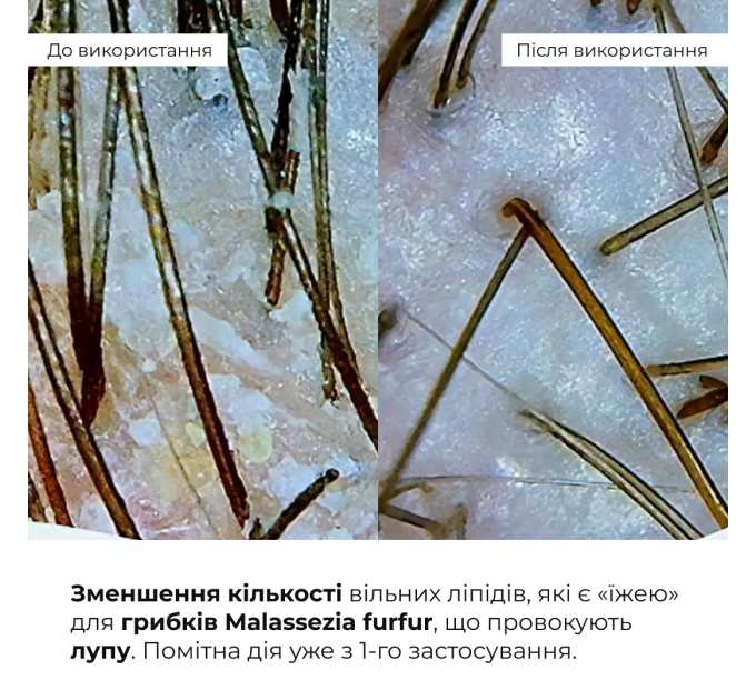 Комплекс для глибокого очищення та відновлення волосся і шкіри голови з термозахистом Hillary Deep Cleanse & Hair Restoration Set with Heat Protection