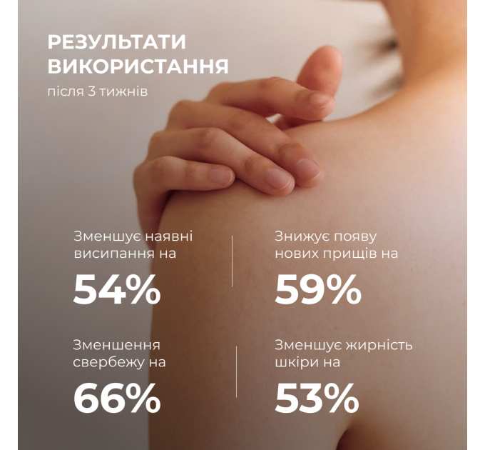 Комплекс для тіла проти висипань і сонячного пошкодження SPF 50+ Hillary Body Care Set for Acne-Prone Skin & Sun Protection