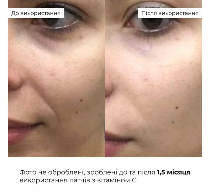 Освіжаючі зміцнювальні патчі з вітаміном C Hillary Vitamin C Refreshing & Firming Eye Patches, 60 шт