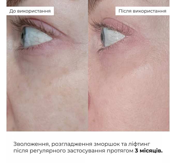 Антивіковий базовий догляд для обличчя Hillary Basic Anti-Aging Care