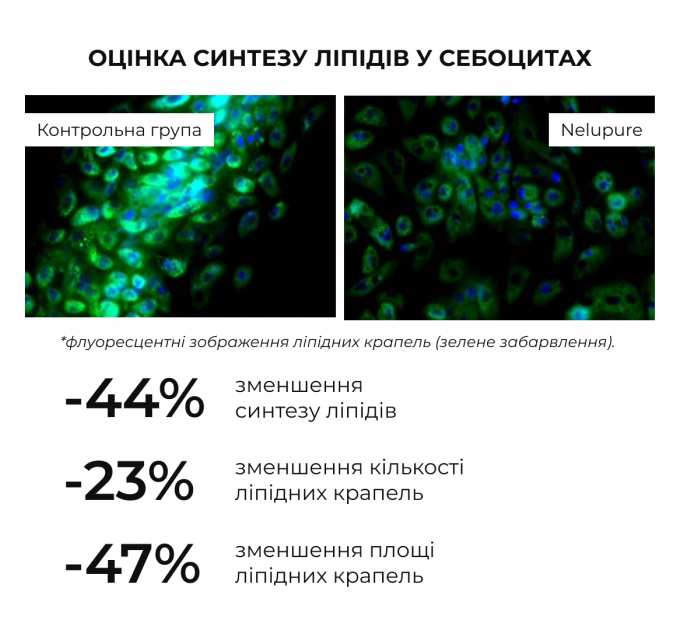 Весняний догляд для жирного типу шкіри