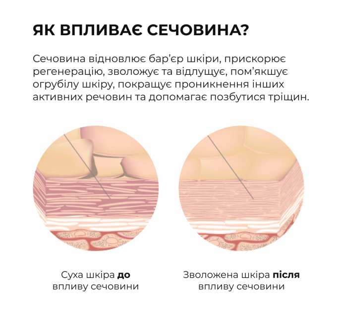 Мʼяка відлущувальна пінка з кислотами для тіла Hillary Soft Exfoliation AHA Body Foam, 150 мл