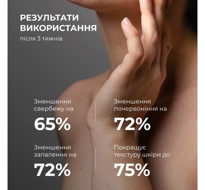 Лосьйон-детокс для проблемної шкіри з саліциловою кислотою Hillary Anti-Acne Salicylic Body Lotion, 150 мл