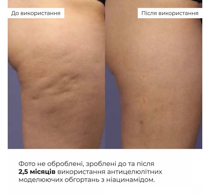Антицелюлітні моделюючі обгортання для тіла з ніацинамідом Hillary Niacinamide Cold Slim
