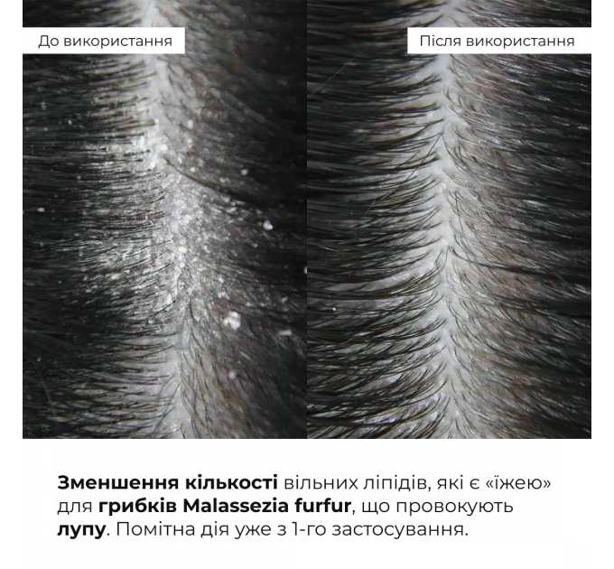 Комплекс для глибокого очищення та відновлення волосся і шкіри голови з термозахистом Hillary Deep Cleanse & Hair Restoration Set with Heat Protection