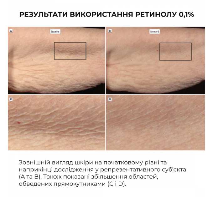 Сироватка для активного відновлення шкіри Hillary ReNuAge Retinol Active Renewal Serum, 30 мл