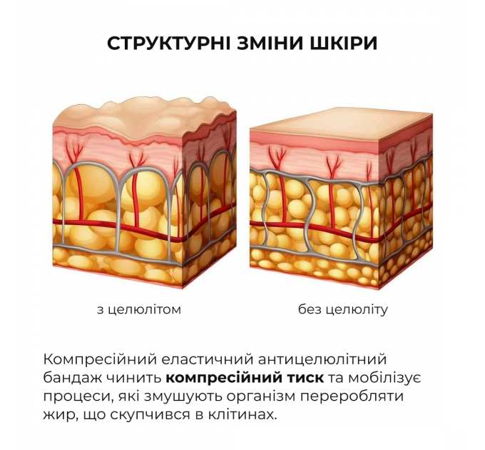 Антицелюлітні моделюючі обгортання для тіла з ніацинамідом Hillary Niacinamide Cold Slim