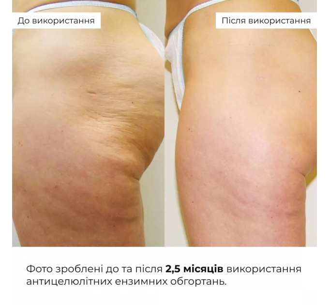 Набір антицелюлітних розігрівальних обгортань Hillary Heating Anti-Cellulite Wrap Set