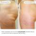 Набір антицелюлітних розігрівальних обгортань Hillary Heating Anti-Cellulite Wrap Set