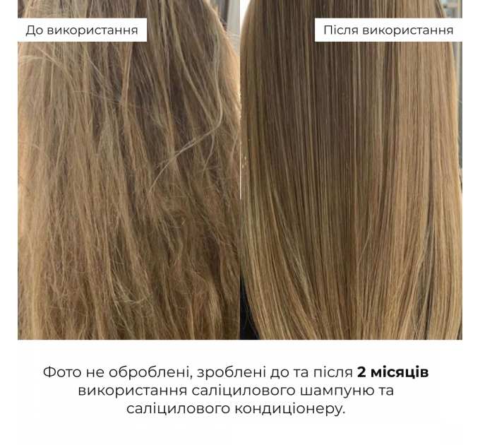 Саліциловий кондиціонер для відновлення волосся Hillary Salicylic Hair Reset Conditioner, 400 мл