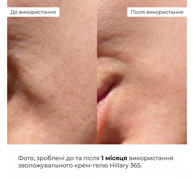 Зволожувальний крем-гель для всіх типів шкіри Hillary Daily Moist 365 Relief Cream, 50 мл