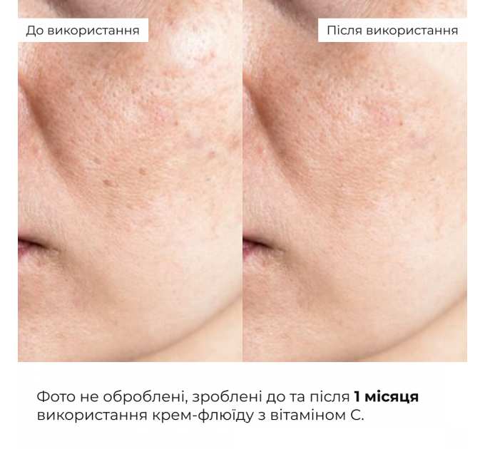 Комплекс для відновлення тону та захист від пігментації Hillary Tone Repair & Pigment Defense Set