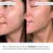 Комплекс для зниження реактивності та освітлення шкіри Hillary Skin Reactivity Reduction & Brightening Complex