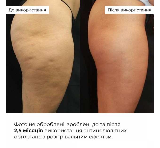 Набір антицелюлітних розігрівальних обгортань Hillary Heating Anti-Cellulite Wrap Set